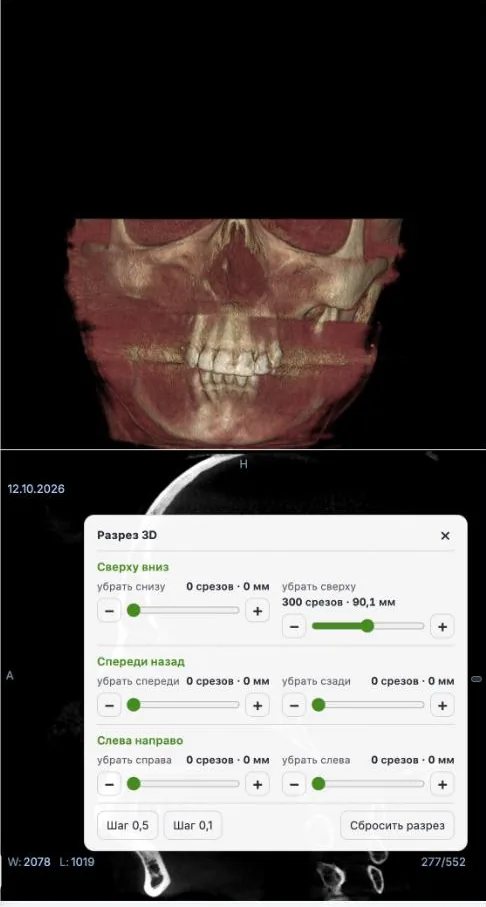 Панель «Разрез 3D» с ползунками и кнопками шага